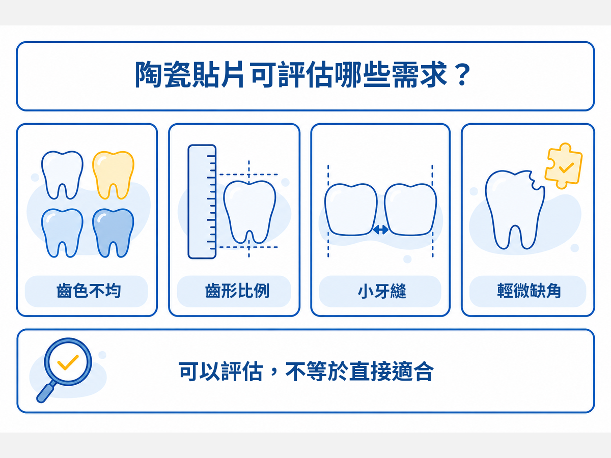 陶瓷貼片可評估齒色不均、齒形比例、小牙縫與輕微缺角等外觀需求